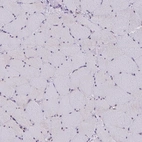 Immunohistochemical staining of human skeletal muscle shows no cytoplasmic positivity in myocytes as expected.