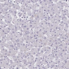Immunohistochemical staining of human liver shows no cytoplasmic positivity in hepatocytes as expected.