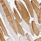 Immunohistochemical staining of human skeletal muscle shows strong cytoplasmic positivity in myocytes.