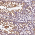 Immunohistochemical staining of human small intestine shows moderate cytoplasmic granular positivity in glandular cells.