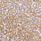 Immunohistochemical staining of human stomach shows moderate cytoplasmic granular positivity in glandular cells.