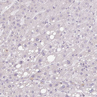 Anti-HMCN2 Antibody