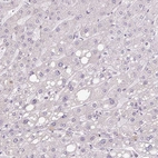 Immunohistochemical staining of human liver shows negative positivity in hepatocytes as expected.