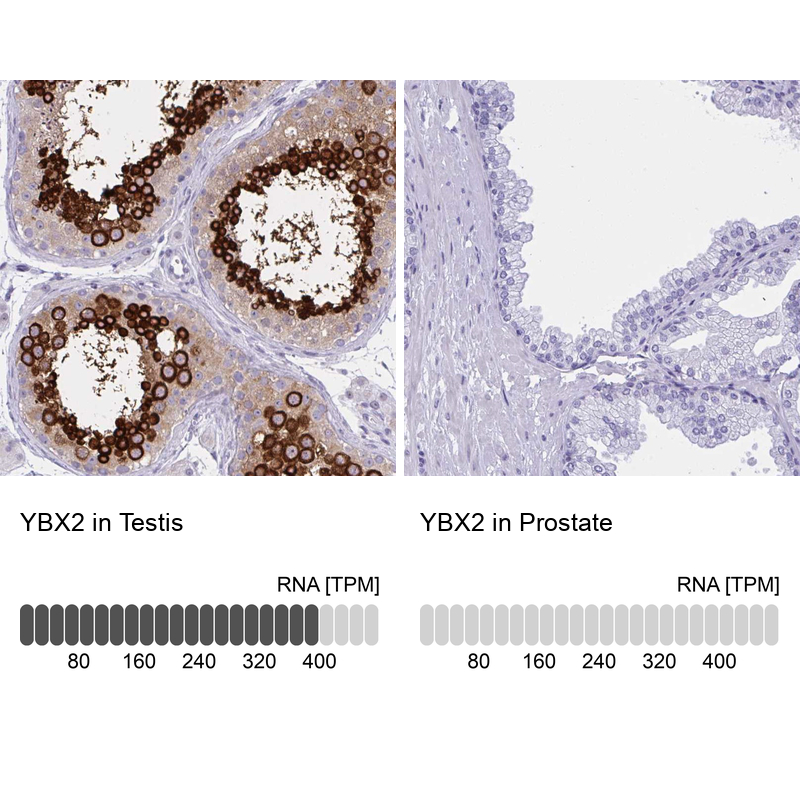 Anti-YBX2 Antibody