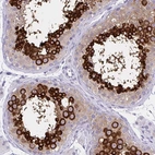 Immunohistochemical staining of human testis shows high expression.