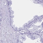 Immunohistochemical staining of human prostate shows low expression as expected.