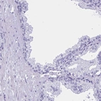 Immunohistochemical staining of human prostate shows low expression as expected.