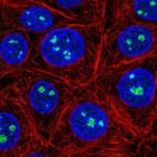 Immunofluorescent staining of human cell line MCF7 shows localization to nucleoli fibrillar center.