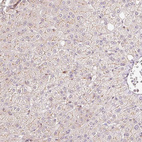 Immunohistochemical staining of human liver shows very weak membranous positivity in hepatocytes.