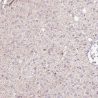Immunohistochemical staining of human liver shows very weak membranous positivity in hepatocytes.