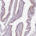 Immunohistochemical staining of human Fallopian tube shows very weak positivity in apical membrane in glandular cells.