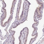 Immunohistochemical staining of human Fallopian tube shows very weak positivity in apical membrane in glandular cells.