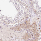 Immunohistochemical staining of human testis shows weak cytoplasmic positivity in Leydig cells.