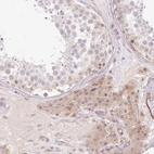 Immunohistochemical staining of human testis shows weak cytoplasmic positivity in Leydig cells.