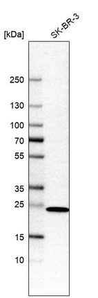 Anti-DHRS2 Antibody