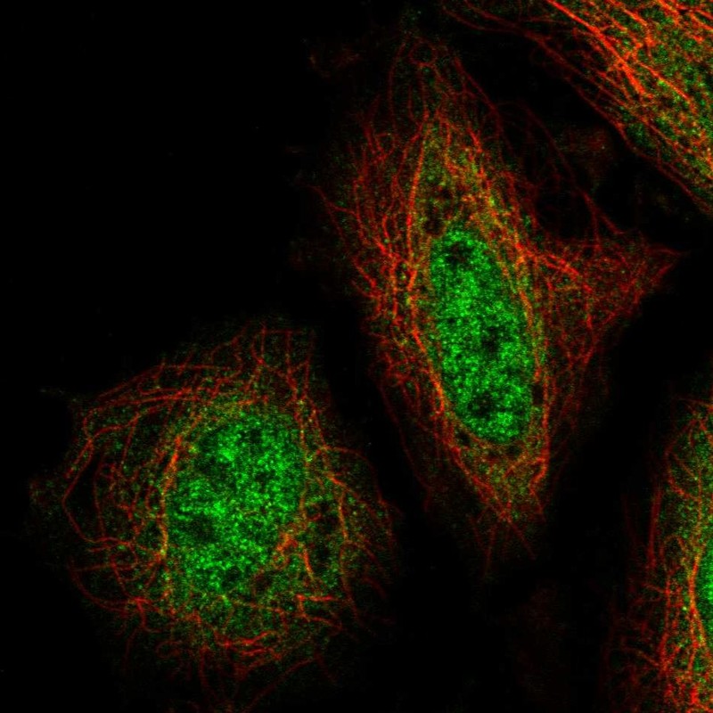Anti-ZNF34 Antibody