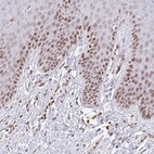 Anti-HOXC10 Antibody