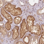 Anti-PCDHB1 Antibody