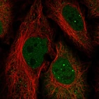 Immunofluorescent staining of human cell line HeLa shows localization to nucleoplasm & nuclear bodies.