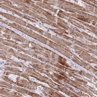 Anti-MT-ND4 Antibody