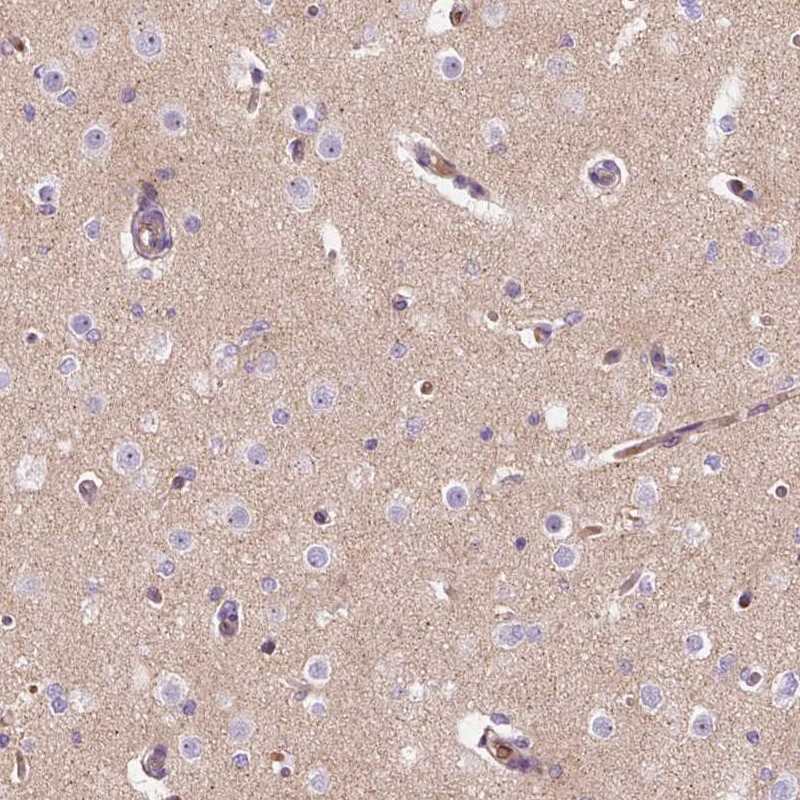 Anti-TMEM235 Antibody
