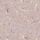 Anti-TMEM235 Antibody