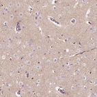Anti-TMEM235 Antibody