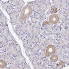 Immunohistochemical staining of human Salivary gland shows moderate granular cytoplasmic positivity in ductal cells.