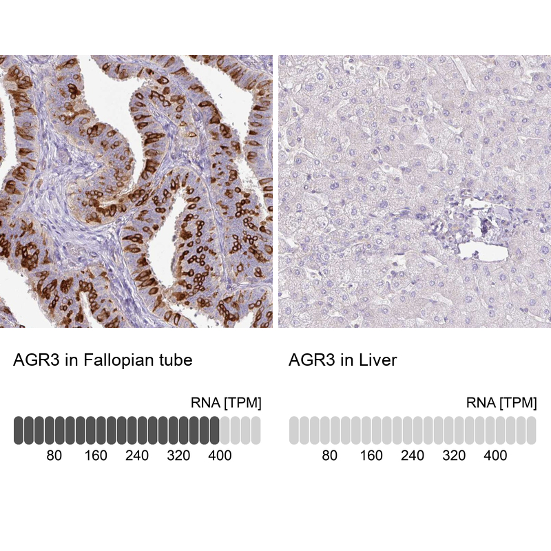 Anti-AGR3 Antibody