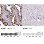Anti-AGR3 Antibody