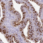 Immunohistochemical staining of human fallopian tube shows high expression.