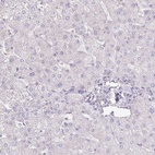 Anti-AGR3 Antibody