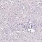 Immunohistochemical staining of human liver shows low expression as expected.