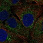 Immunofluorescent staining of human cell line U-2 OS shows localization to endoplasmic reticulum & vesicles.