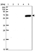 Lane 1: Marker [kDa] 250, 130, 95, 72, 55, 36, 28, 17, 10_br/_Lane 2: Human cell line RT-4_br/_Lane 3: Human cell line U-251MG sp_br/_Lane 4: Human plasma (IgG/HSA depleted)_br/_Lane 5: Human liver tissue