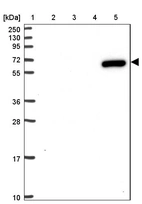 Lane 1: Marker [kDa] 250, 130, 95, 72, 55, 36, 28, 17, 10_br/_Lane 2: Human cell line RT-4_br/_Lane 3: Human cell line U-251MG sp_br/_Lane 4: Human plasma (IgG/HSA depleted)_br/_Lane 5: Human liver tissue