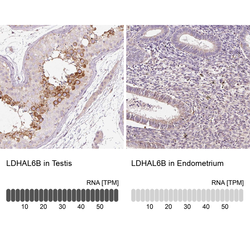 Anti-LDHAL6B Antibody