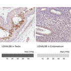 Anti-LDHAL6B Antibody