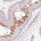 Immunohistochemical staining of human testis shows high expression.
