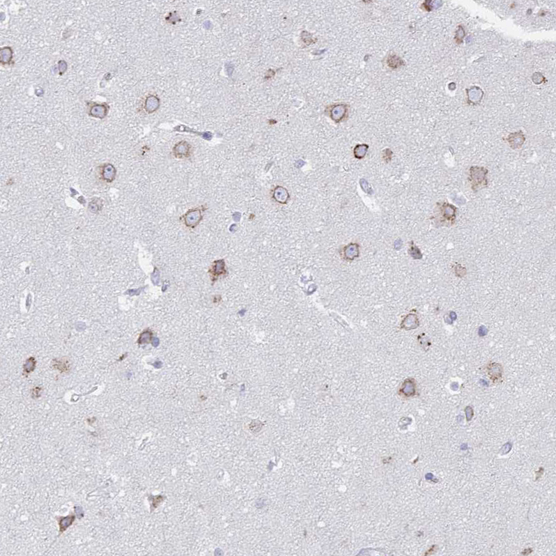 Anti-VKORC1L1 Antibody