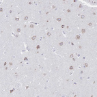 Anti-VKORC1L1 Antibody
