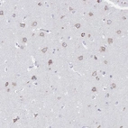 Anti-VKORC1L1 Antibody