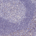 Immunohistochemical staining of human tonsil shows strong granular cytoplasmic positivity in germinal center cells.
