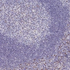 Immunohistochemical staining of human tonsil shows strong granular cytoplasmic positivity in germinal center cells.