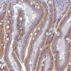 Immunohistochemical staining of human duodenum shows strong granular cytoplasmic positivity in glandular cells.