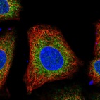 Immunofluorescent staining of human cell line A549 shows localization to endoplasmic reticulum.