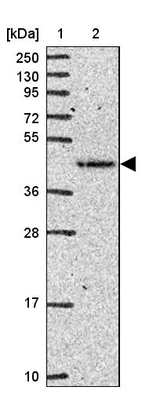Lane 1: Marker [kDa] 250, 130, 95, 72, 55, 36, 28, 17, 10_br/_Lane 2: Human cell line RT-4