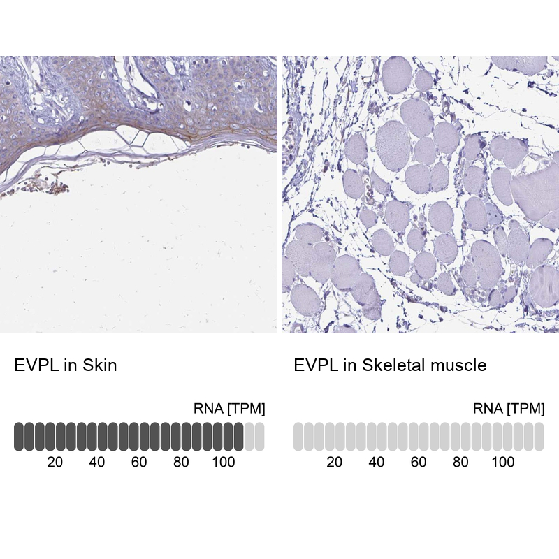 Anti-EVPL Antibody