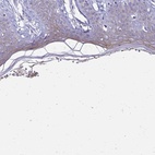 Immunohistochemical staining of human skin shows high expression.