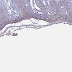Immunohistochemical staining of human skin shows high expression.